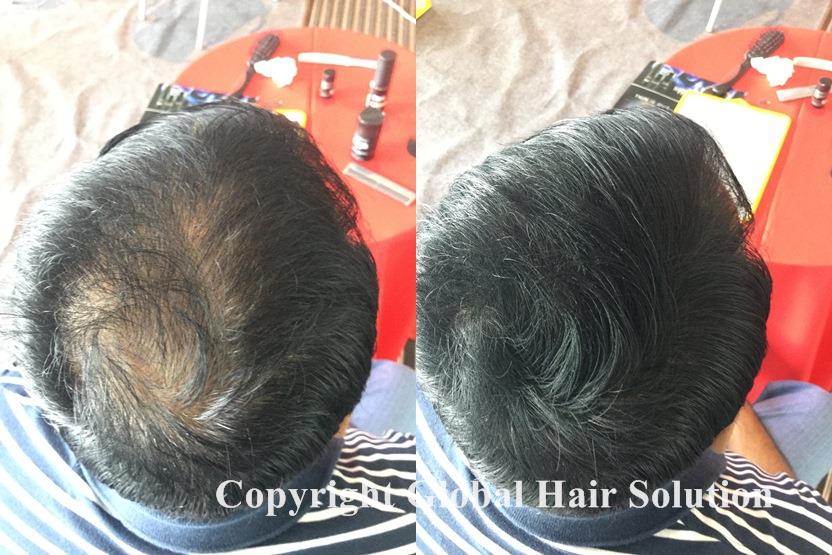 hair grow solution malaysia